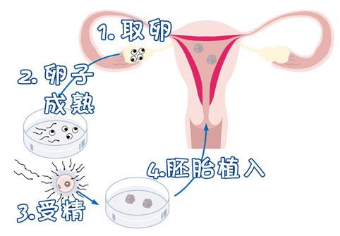 拉拉供卵服务微信群